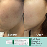 سرم ضدلک و روشن کننده اکسیییییسس وای مدل Dark Spot ساخت کره با ضمانت اصل بودن کالا - ضدلک با ضمانت