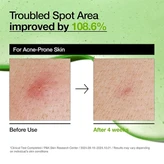 سرم آزلائیک اسید 10% و هیالورون آنوا Anua Azelaic Acid 10+ Hyaluron Soothing Serum 30M