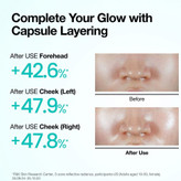 اسپری میست کپسولی آبرسان پی دی آر ان آنوا Anua Pdrn Hyaluronic Acid Hydrating Capsule Mist